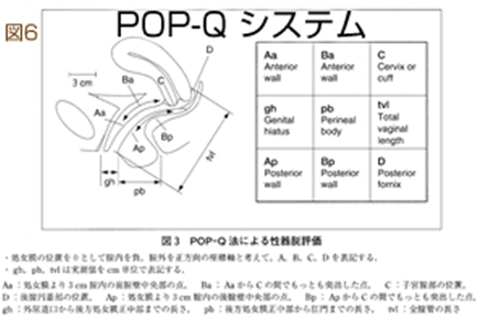 POP-Qシステム